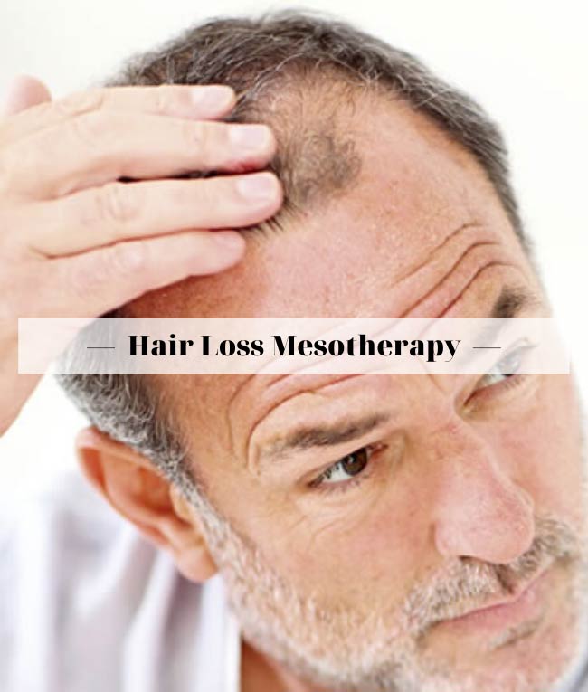 MESOTHERAPY FOR HAIRLOSS - Ζωή Φίκα